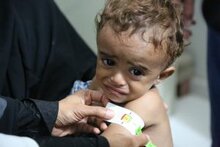 Comunicato stampa: Il WFP allarmato per i crescenti tassi di fame e malnutrizione nello Yemen in conflitto